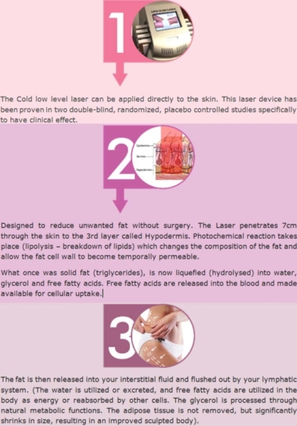 Lipo Laser