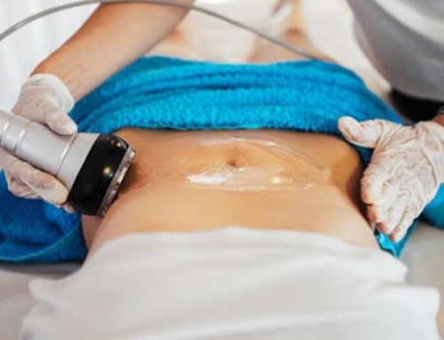Radio Frequency Cavitation
